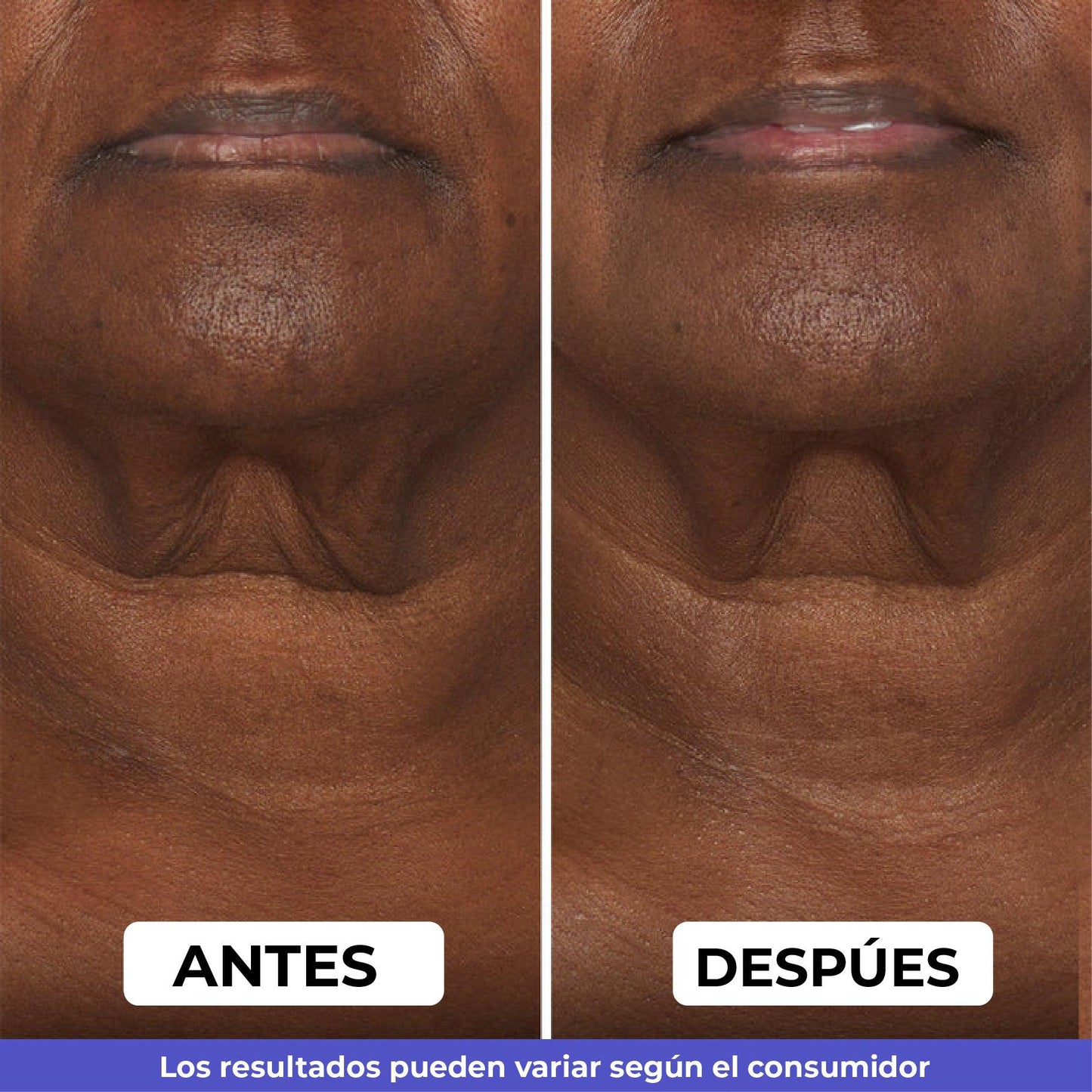 Elimina la flacidez del cuello y luce 10 años más joven | Crema Reafirmante GoPure® 2x1 💎