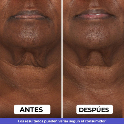 Elimina la flacidez del cuello y luce 10 años más joven | Crema Reafirmante GoPure® 2x1 💎